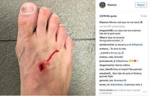 苏神将马竞铁卫踩出血洞 拒不道歉要为梅西报仇?